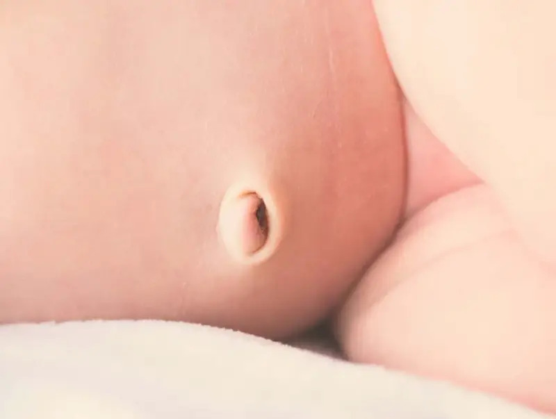 Primer plano de la piel de un bebé, mostrando un ombligo con una leve hernia umbilical.