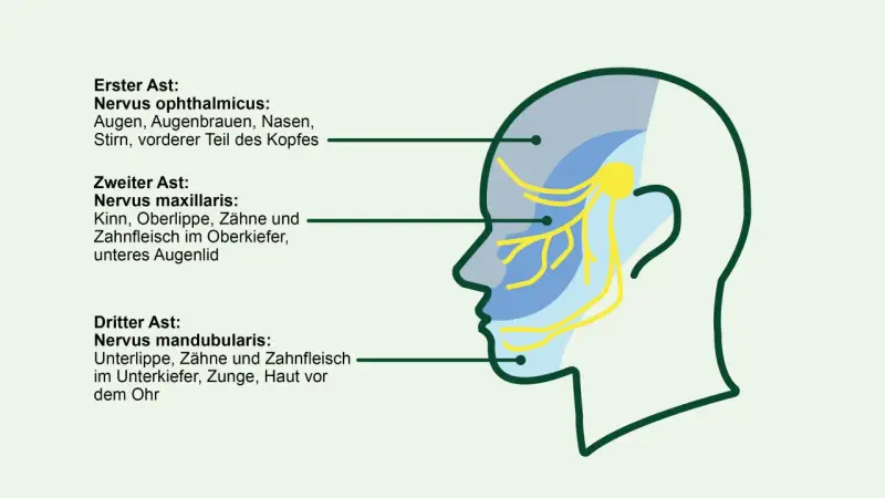 Schema des Trigeminusnervs mit seinen drei Ästen, die verschiedene Gesichtsbereiche versorgen. Eine sanfte Massage kann hier Linderung verschaffen.