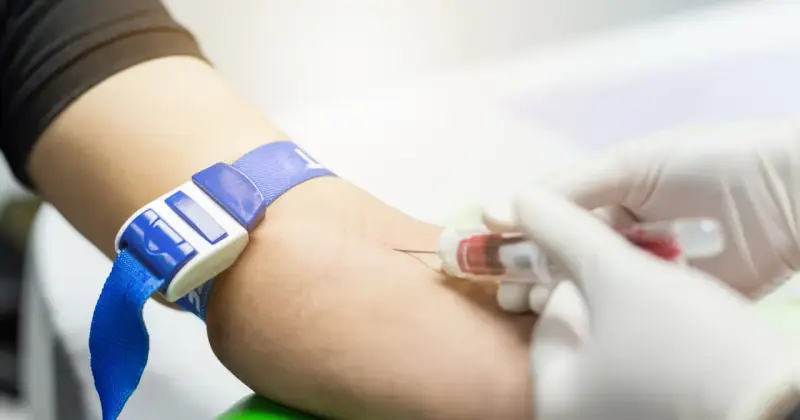 Pobieranie krwi do badań, w tym APTT. Ręka z opaską uciskową, igła i probówka.