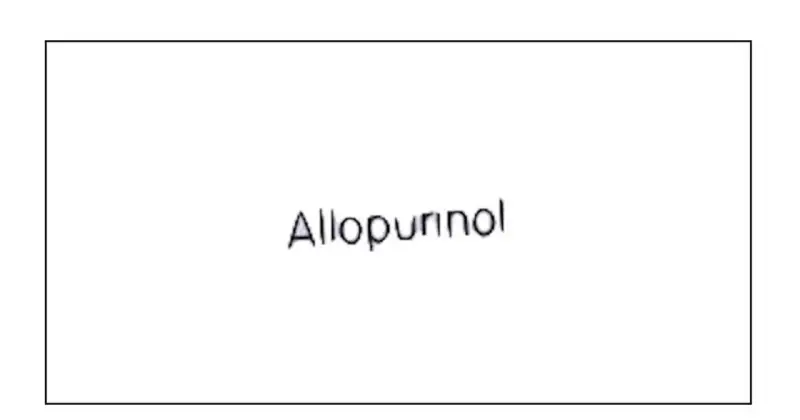 Napis "Allopurinol" na białym tle. Lek Milurit 300 pomaga w leczeniu dny moczanowej.