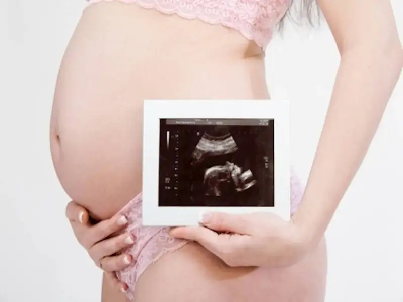 Ciężarna kobieta trzyma zdjęcie USG. To badanie, które pokazuje, co oznacza rozwój dziecka.