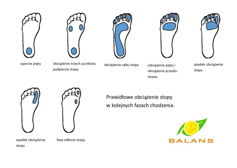 Ilustracje pokazują prawidłowe obciążenie stopy w chodzeniu, od pięty po palce. Brak prawidłowego podparcia łuku stopy może prowadzić do płaskostopie.