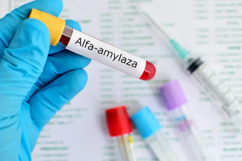 Amylaza podwyższona: co oznacza? Kiedy pilnie do lekarza?