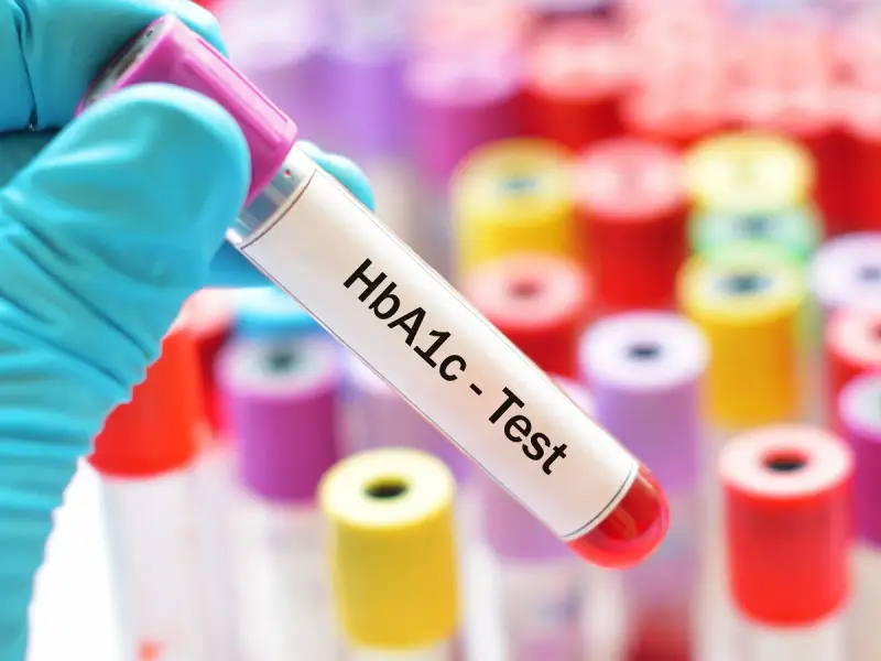 Ręka w niebieskiej rękawiczce trzyma probówkę z napisem "HbA1c - Test". W tle kolorowe probówki. Sprawdź, jaka jest hemoglobina glikowana cena.