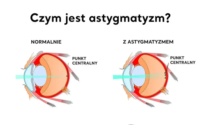 Astygmatyzm: okulary czy soczewki? Porównaj i wybierz mądrze!
