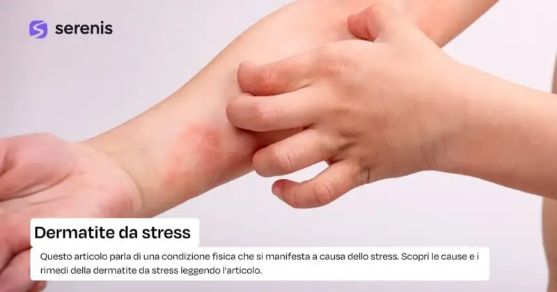 Braccio con arrossamento e sfogo cutaneo, un dito che si gratta. Potrebbe essere dermatite da stress senza prurito.