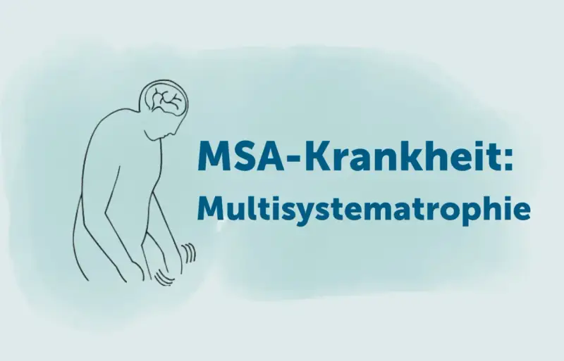 Stilisierte Darstellung eines Menschen mit Zittern in den Händen, der die MSA-Krankheit (Multisystematrophie) im Endstadium symbolisiert.