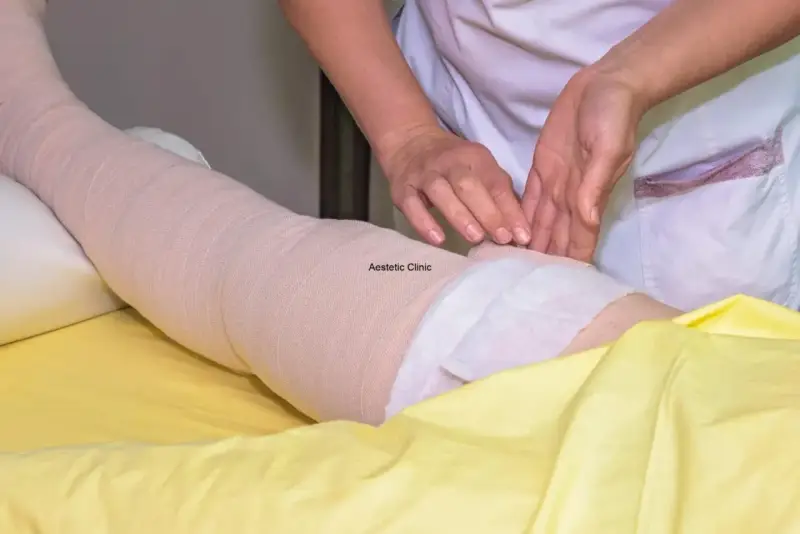 Noga owinięta bandażem kompresyjnym, ręce terapeuty.