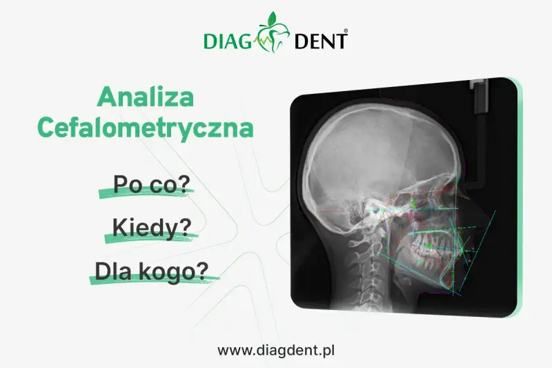 Analiza cefalometryczna: zdjęcie RTG czaszki z naniesionymi liniami i kątami. Pytania: Po co? Kiedy? Dla kogo?