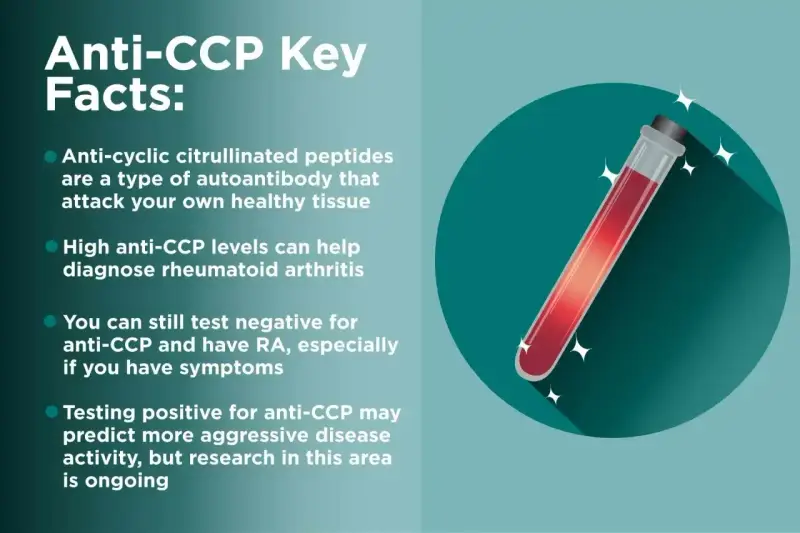 Kluczowe fakty o anty-CCP: przeciwciała atakujące tkanki, wysoki poziom anty-CCP pomaga diagnozować RZS. Test anty-CCP może przewidywać agresywność choroby.
