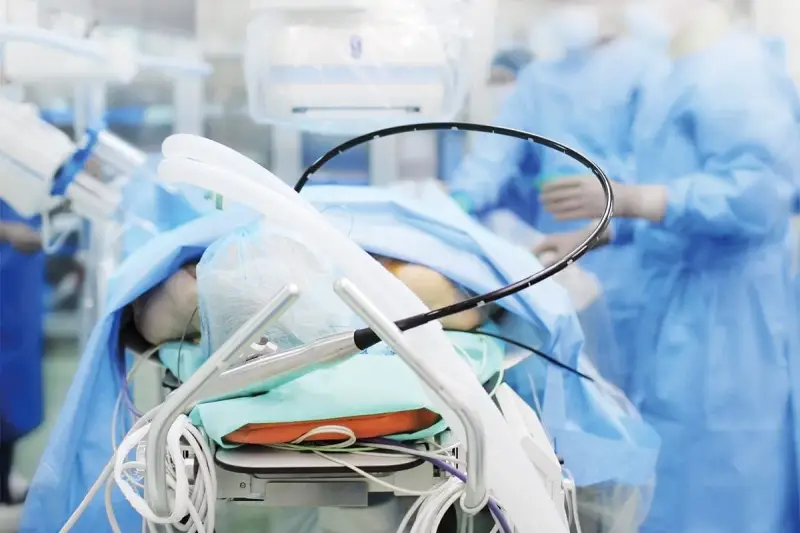 Pacjent na stole operacyjnym, przygotowany do zabiegu PCI kardiologia. W tle personel medyczny w niebieskich fartuchach.
