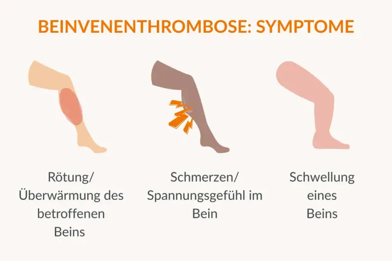 Rötung, Schmerzen und Schwellung am Bein sind Symptome, die auf eine Thrombose hinweisen können. Achte auf diese Anzeichen!