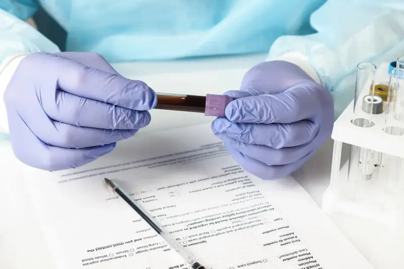 Ręce w rękawiczkach trzymają probówkę z krwią. Wyniki badań wskazują na eozynofile niskie, co może wymagać dalszej diagnostyki.
