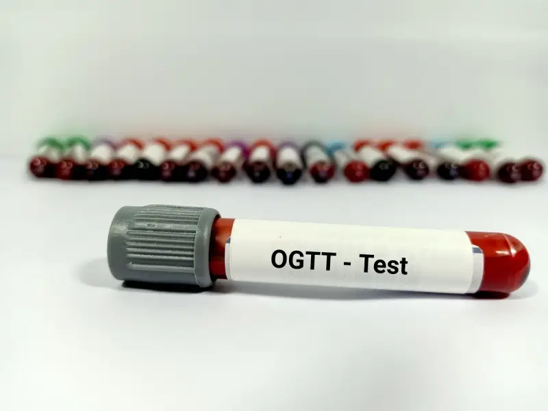 Probówka z oznaczeniem OGTT - Test na tle wielu innych próbek krwi.