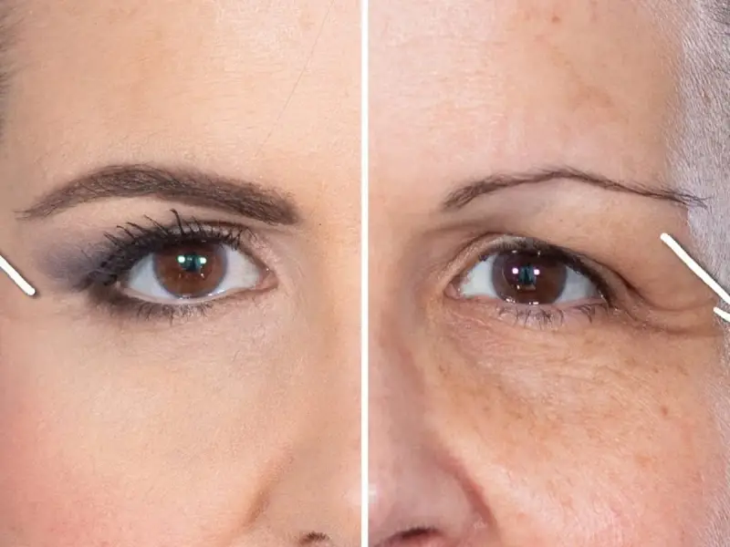 Comparaison avant/après : une jeune femme avec des sourcils bien dessinés et une femme plus âgée cherchant à remonter les sourcils naturellement.