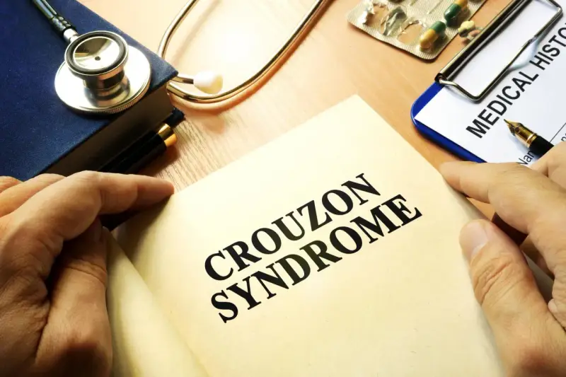 Książka z napisem "CROUZON SYNDROME", stetoskop, dokument "MEDICAL HISTO" i lekarstwa.