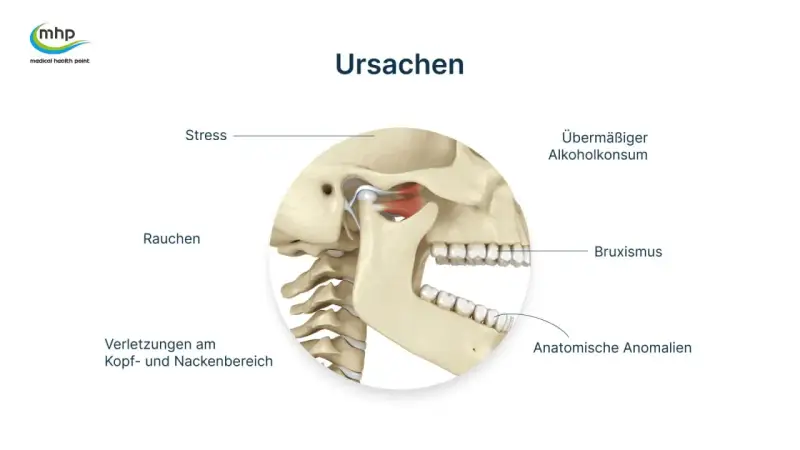 Kiefergelenk: Ursachen wie Stress, Rauchen, Bruxismus, Verletzungen, übermäßiger Alkoholkonsum und anatomische Anomalien. Physiotherapie Kiefergelenk was wird gemacht?
