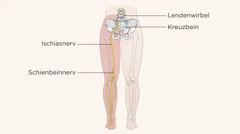 Illustration des Ischiasnervs, der vom Kreuzbein bis ins Bein verläuft. Ein Geheimtipp bei Ischias: Verständnis der Anatomie.