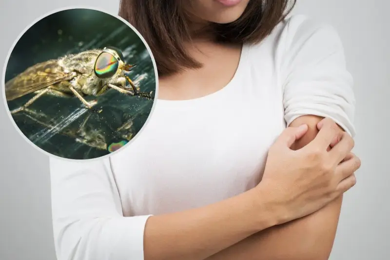 Kobieta drapie ramię po ugryzieniu muchy końskiej. Widok z bliska na owada z tęczowymi oczami.