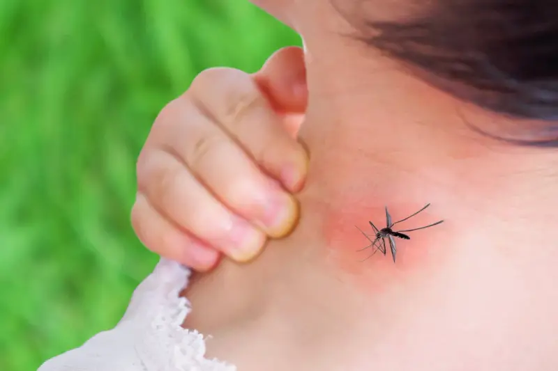 Dziecko drapie zaczerwienione miejsce na szyi po ukąszeniu komara. Rumień jest widoczny.