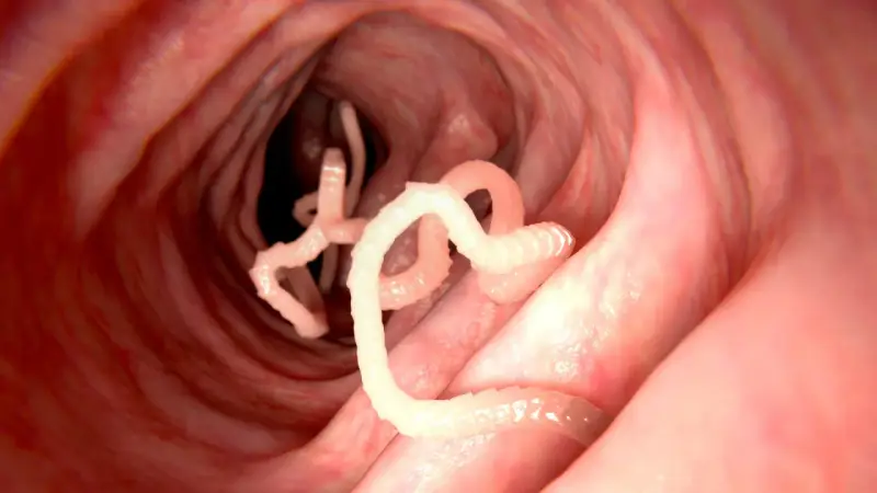 Würmer im Darm: Nahaufnahme von Parasiten, die sich in einem roten, schleimigen Darmwinden.