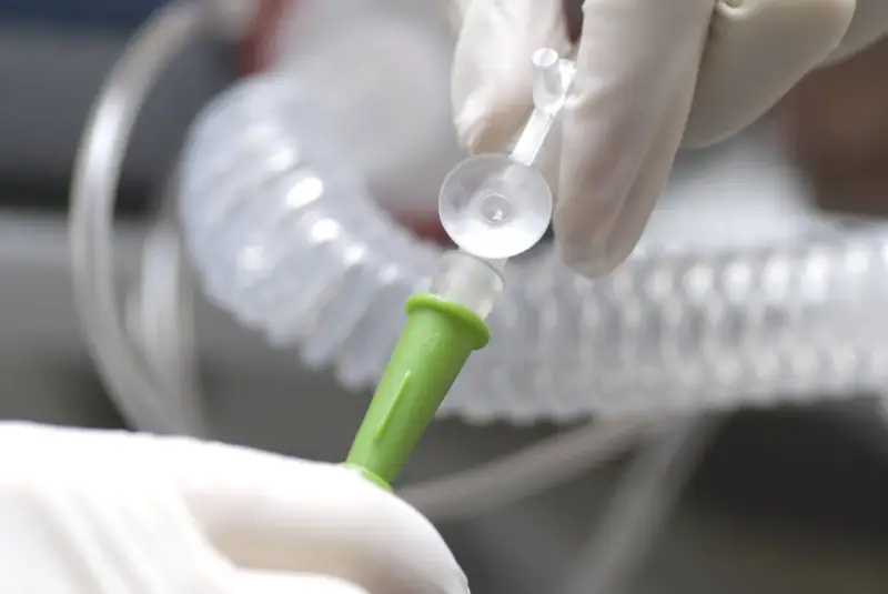Hände in Handschuhen verbinden ein medizinisches Schlauchsystem. Mögliche Nachteile einer PEG-Sonde sind Infektionen und Verstopfungen.