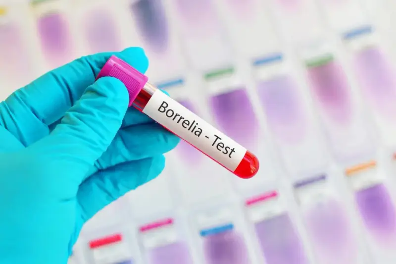 Ręka w niebieskiej rękawiczce trzyma probówkę z napisem "Borrelia - Test". To klucz do odpowiedzi, gdzie zrobić badania na boreliozę.