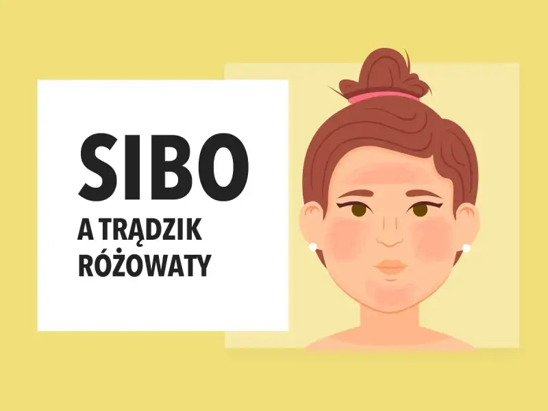SIBO może objawiać się jako trądzik różowaty. Ilustracja przedstawia twarz z zaczerwienieniami na policzkach i nosie, sugerując problemy skórne.