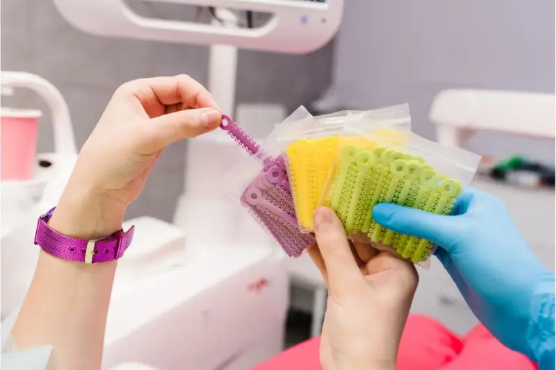 Kolorowe ligatury ortodontyczne w opakowaniach, gotowe do założenia aparatu.