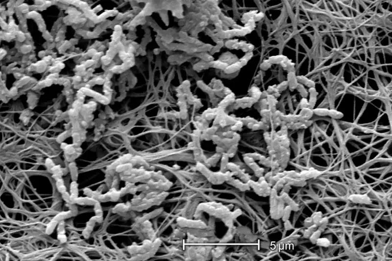 Achromobacter xylosoxidans, batteri filamentosi che colonizzano una matrice extracellulare fibrosa.