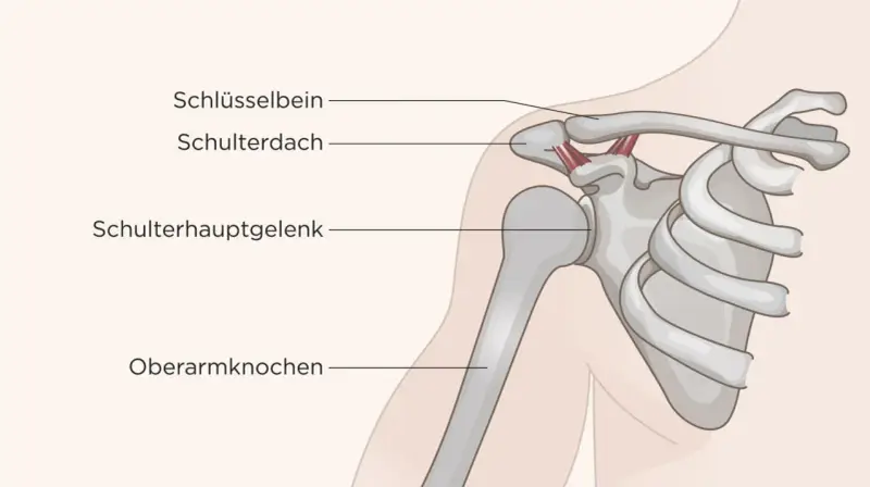 Anatomie der Schulter: Schlüsselbein, Schulterdach, Schulterhauptgelenk und Oberarmknochen. Die Heilung des Schulter-Arm-Syndroms kann variieren.