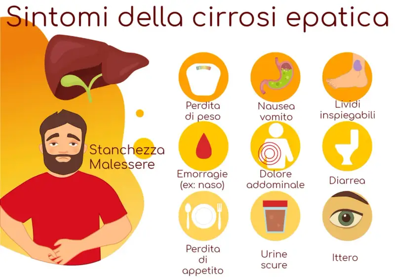 Sintomi della cirrosi epatica: stanchezza, perdita di peso, nausea, emorragie, dolore addominale, lividi, ittero e altri.
