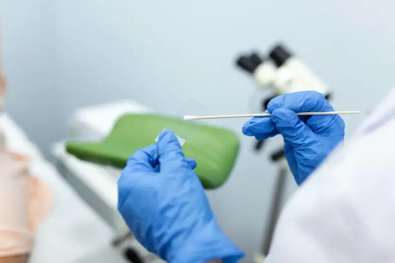 Ręce w niebieskich rękawiczkach przygotowują próbkę do badań cytologia wyniki. W tle mikroskop i fotel ginekologiczny.