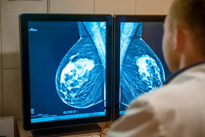Lekarz analizuje mammografię piersi na ekranie. Wyniki badań, jak te z systemu armidex, są kluczowe dla wczesnego wykrywania.