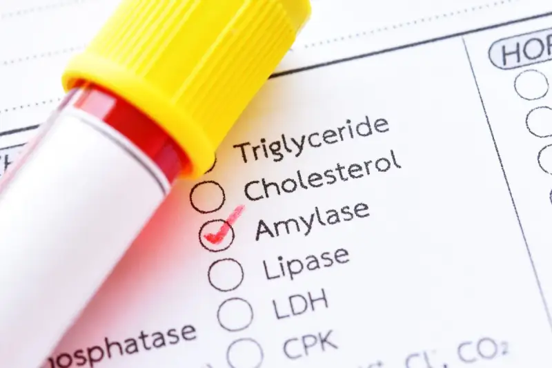 Esame del sangue con provetta e modulo di analisi. La casella "Amylase" è spuntata, indicando un controllo dei valori normali di amilasi.