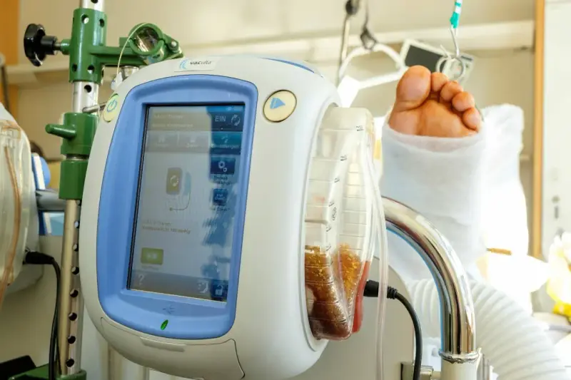 V.A.C.® Therapy Gerät mit gefülltem Behälter und einem Fuß im Verband. Die vac pumpe unterstützt die Wundheilung.
