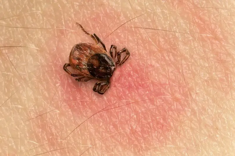 Makro zbliżenie na kleszcza przyczepionego do ludzkiej skóry. Widać jego nogi i odwłok.