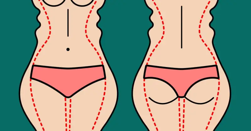 Ilustracja pokazuje sylwetkę przed i po zabiegu liposukcji ud. Czerwone linie zaznaczają obszary do modelowania.