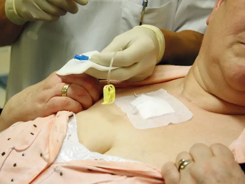 Eine Pflegekraft mit Handschuhen bereitet die Infusion an einem Port vene vor.