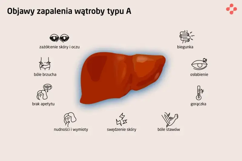 Objawy zapalenia wątroby typu A: zażółcenie skóry, bóle brzucha, brak apetytu, nudności, biegunka, osłabienie, gorączka, bóle stawów, swędzenie skóry.