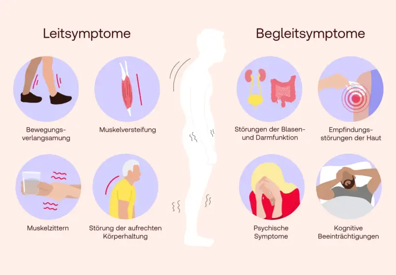 Die Grafik zeigt Leitsymptome wie verlangsamte Bewegung, Muskelsteifheit und Zittern, die auf eine Parkinson-Definition hinweisen. Begleitsymptome umfassen Blasen-/Darmstörungen, Hautempfindungsstörungen, psychische und kognitive Probleme.