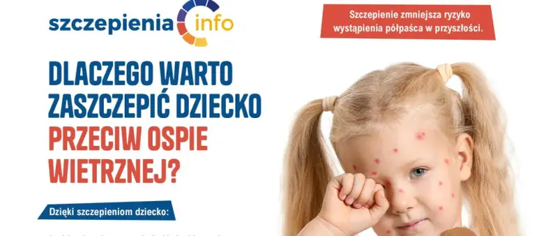 Dziewczynka z ospą wietrzną. Kampania informacyjna o szczepionce na ospę, podkreślająca jej znaczenie dla zdrowia dziecka.