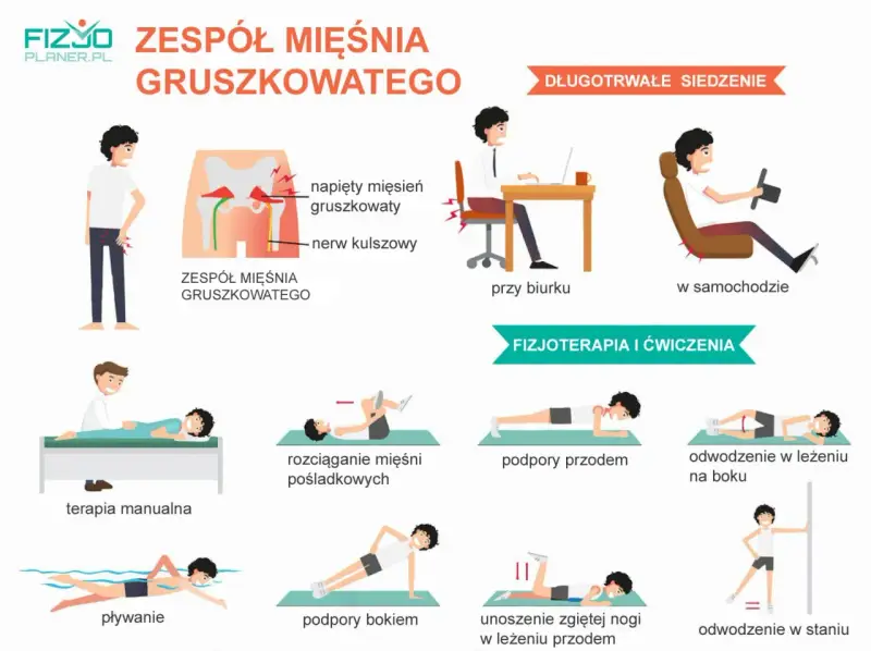 Ilustracja pokazuje zespół mięśnia gruszkowatego, jego przyczyny (długotrwałe siedzenie) i metody leczenia (fizjoterapia, ćwiczenia, terapia manualna).
