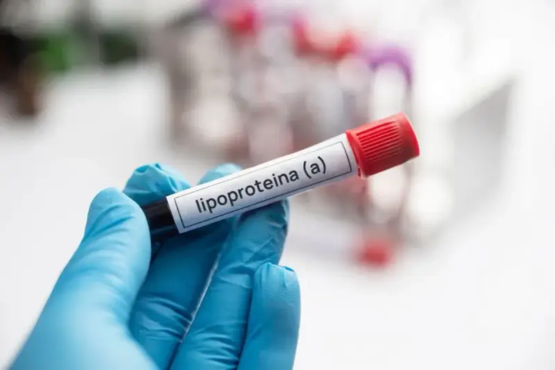 Ręka w niebieskiej rękawiczce trzyma probówkę z etykietą "lipoproteina (a)". Badanie poziomu tej lipoproteiny jest ważne.