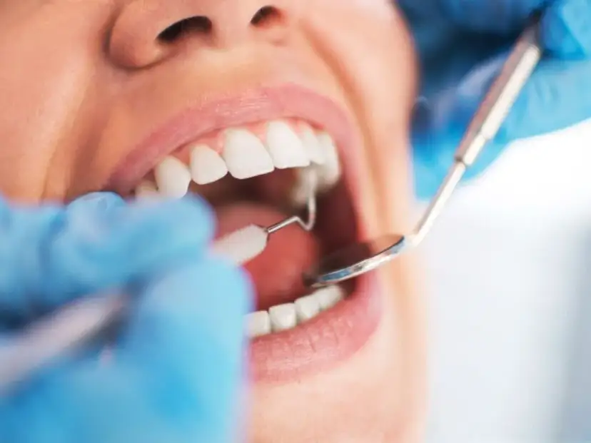 Dentysta wykonuje sanację jamy ustnej, używając lusterka i szczoteczki do czyszczenia zębów.