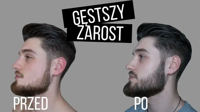 Jak przyspieszyć zarost? Ekspert radzi, co naprawdę działa.