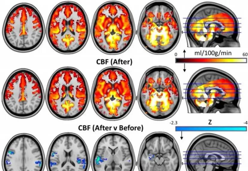 Psylocybina na depresję: Czy "resetuje" mózg? Badania i prawo