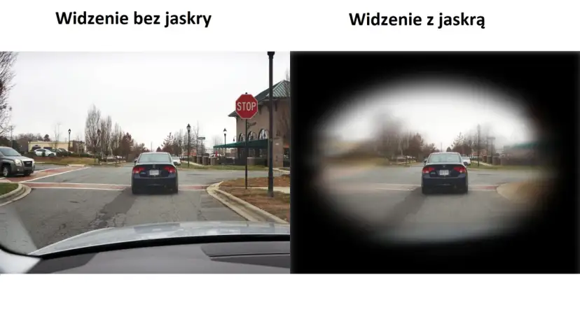 Porównanie widzenia: po lewej - normalne, po prawej - z jaskrą (widoczne ubytki w polu widzenia).
