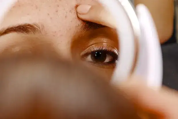 Skuteczne sposoby na pryszcze na czole – jak się ich pozbyć raz na zawsze