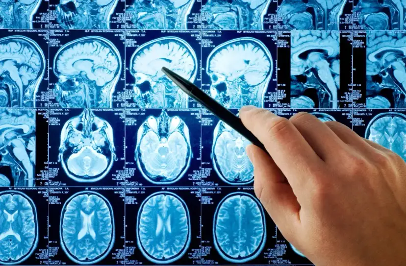 Jakie choroby psychiczne wykryje rezonans magnetyczny głowy i jak to działa